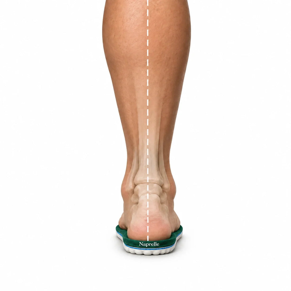 Illustration of a centered ankle on a green Naprelle insole, with a straight alignment line